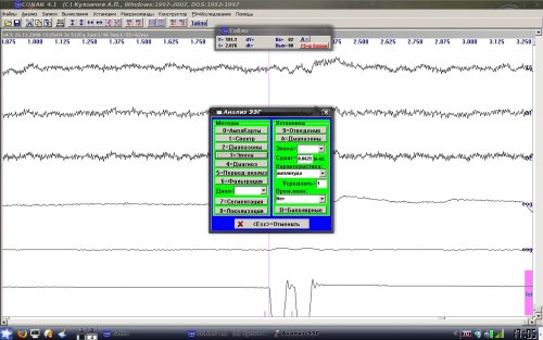 Анализ ЭЭГ в Conan-m